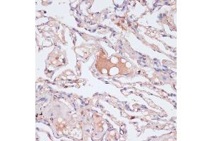 Immunohistochemistry (IHC) image for anti-Interferon gamma (IFNG) (AA 24-166) antibody (ABIN6142195)