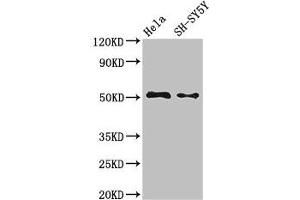Western Blot Positive WB detected in: Hela whole cell lysate, SH-SY5Y whole cell lysate All lanes: FADS1 antibody at 3. (FADS1 抗体  (AA 1-121))