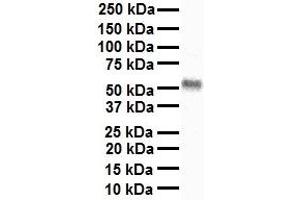 Western Blotting (WB) image for anti-Thyroid Hormone Receptor, alpha (THRA) (Middle Region) antibody (ABIN2776019)