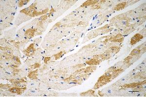 Immunohistochemistry was performed on paraffin-embedded mouse heart using vascular endothelial growth factor D antibody (ABIN7797810), 1:200).