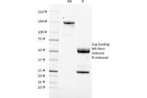 SDS-PAGE Analysis Purified CD21 / CR2 Mouse Monoclonal Antibody (CR2/1953). (CD21 抗体  (AA 44-196))