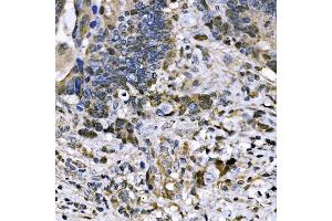 IHC analysis of BUB1 using anti-BUB1 antibody (ABIN7600942).