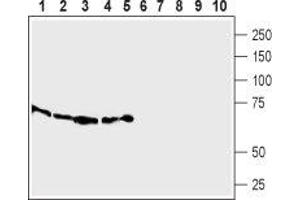 Western Blotting (WB) image for anti-Solute Carrier Family 7 (Cationic Amino Acid Transporter, Y+ System), Member 2 (SLC7A2) (AA 151-163), (Extracellular) antibody (ABIN7043748)