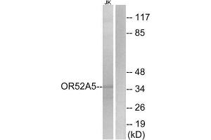 Western Blotting (WB) image for anti-Olfactory Receptor 52A5 (OR52A5) (Internal Region) antibody (ABIN1853402) (OR52A5 抗体  (Internal Region))