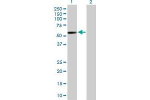 Western Blot analysis of GAL3ST4 expression in transfected 293T cell line by GAL3ST4 MaxPab polyclonal antibody. (GAL3ST4 抗体  (AA 1-486))