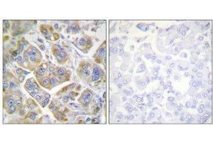 Immunohistochemistry (IHC) image for anti-Integrin beta 4 (ITGB4) (Tyr1510) antibody (ABIN6299079) (Integrin beta 4 抗体  (Tyr1510))