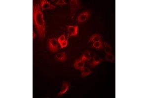 Immunofluorescent analysis of TUSC4 staining in Hela cells. (NPRL2 抗体)