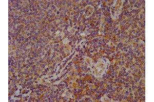 IHC image of ABIN7152326 diluted at 1:600 and staining in paraffin-embedded human lymph node tissue performed on a Leica BondTM system. (FAM62B 抗体  (AA 567-736))
