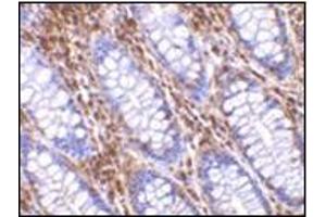 Immunohistochemistry of OMI in human colon tissue with this product at 10 μg/ml. (HTRA2 抗体  (C-Term))