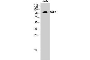 Western Blotting (WB) image for anti-Adrenergic, Beta, Receptor Kinase 1 (ADRBK1) (Ser129) antibody (ABIN3175424) (GRK2 抗体  (Ser129))