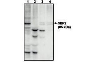 Image no. 1 for anti-SH3-Domain Binding Protein 2 (SH3BP2) antibody (ABIN291998) (SH3BP2 抗体)