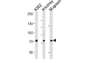 Western blot analysis of lysates from K562 cell line, human kidney, mouse spleen tissue (from left to right), using SDAD1 Antibody (C-term) (ABIN6244145 and ABIN6577730). (SDAD1 抗体  (C-Term))