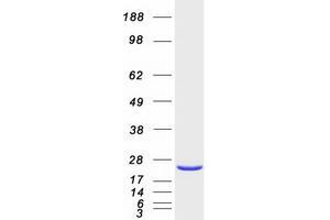 Western Blotting (WB) image for RAP2A, Member of RAS Oncogene Family (RAP2A) protein (Myc-DYKDDDDK Tag) (ABIN2730478)