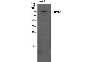Western Blotting (WB) image for anti-LIM Domain Kinase 1 (LIMK1) (Internal Region) antibody (ABIN3185384) (LIM Domain Kinase 1 抗体  (Internal Region))