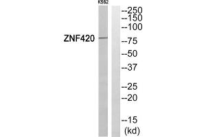 Western blot analysis of extracts from K562 cells, using ZNF420 antibody. (ZNF420 抗体  (Internal Region))