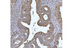 IHC analysis of FEN1 using anti-FEN1 antibody (ABIN7601619).