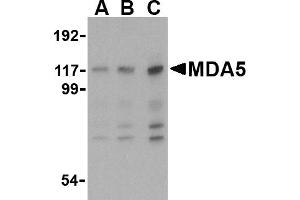 Western blot analysis of MDA5 in Daudi cell lysate with MDA5 antibody at (A) 1, (B) 2 and (C) 4 µg/mL. (IFIH1 抗体  (Middle Region))