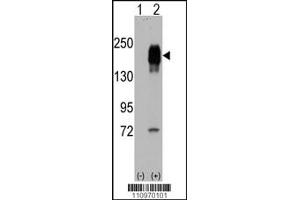 Western blot analysis of EGFR using rabbit polyclonal EGFR Antibody. (EGF 抗体  (AA 847-876))