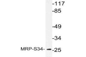 Western blot (WB) analysis of MRP-S34 antibody in extracts from Jurkat cells. (MRPS34 抗体)