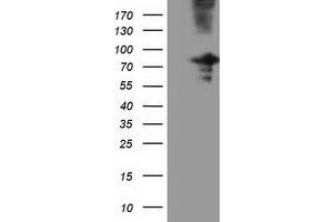 Western Blotting (WB) image for anti-Oxysterol Binding Protein-Like 11 (OSBPL11) antibody (ABIN1499923) (OSBPL11 抗体)