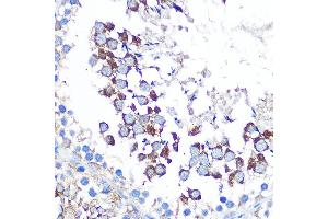 Immunohistochemistry of paraffin-embedded rat testis using WISP2 Rabbit pAb (ABIN6128929, ABIN6150227, ABIN6150229 and ABIN6223338) at dilution of 1:100 (40x lens). (WISP2 抗体  (AA 1-250))