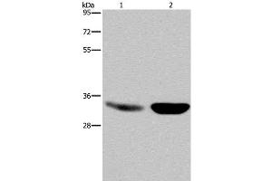 Western Blot analysis of Human fetal brain and Mouse brain tissue using MAPRE3 Polyclonal Antibody at dilution of 1:500 (MAPRE3 抗体)