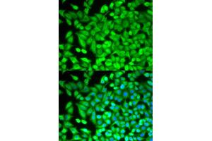 Immunofluorescence (IF) image for anti-Fructose-1,6-Bisphosphatase 1 (FBP1) antibody (ABIN1876594) (FBP1 抗体)