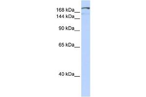 WB Suggested Anti-NFAT5 Antibody Titration:  0. (NFAT5 抗体  (Middle Region))