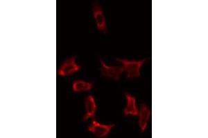 ABIN6274814 staining HeLa by IF/ICC. (SLC25A31 抗体  (Internal Region))