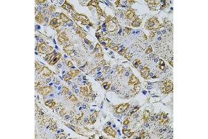 Immunohistochemistry of paraffin-embedded human stomach using GM13125 antibody (ABIN6127294, ABIN6141172, ABIN6141175 and ABIN6216319) at dilution of 1:100 (40x lens). (Pramel15 抗体  (AA 1-477))