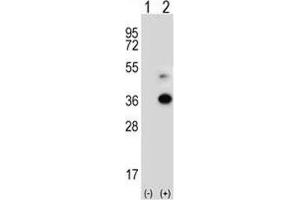 Western blot analysis of ANGPTL7 antibody and 293 cell lysate either nontransfected (Lane 1) or transiently transfected (2) with the ANGPTL7 gene. (ANGPTL7 抗体  (AA 300-350))