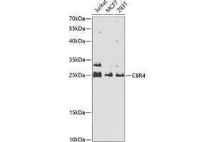 Western blot analysis of extracts of various cell lines, using CBR4 antibody  at 1:1000 dilution. (CBR4 抗体  (AA 1-237))