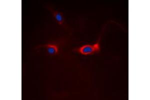 Immunofluorescent analysis of FOXO1 staining in Hela cells. (FOXO1 抗体  (Center))