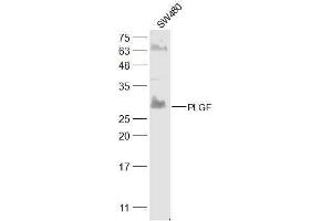 SW480 lysates probed with PLGF Polyclonal Antibody, Unconjugated  at 1:300 dilution and 4˚C overnight incubation. (PLGF 抗体  (AA 166-221))