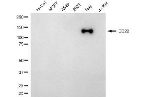 Western blotting analysis using CD22 antibody (ABIN7797960). (CD22 抗体)
