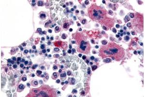 Anti-P2RY12 / P2Y12 antibody  ABIN1049208 IHC staining of human bone marrow, megakaryocytes.