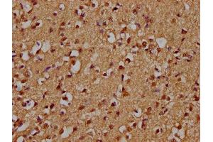 IHC image of ABIN7176307 diluted at 1:300 and staining in paraffin-embedded human brain tissue performed on a Leica BondTM system. (ZFP42 抗体  (AA 50-256))