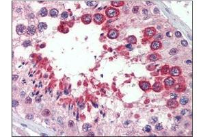 Testis, Human: Formalin-Fixed, Paraffin-Embedded (FFPE) (Reticulon 4 抗体)