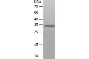 Western Blotting (WB) image for Methylenetetrahydrofolate Dehydrogenase (NADP+ Dependent) 2, Methenyltetrahydrofolate Cyclohydrolase (MTHFD2) (AA 30-350) protein (His tag) (ABIN7123939) (MTHFD2 Protein (AA 30-350) (His tag))