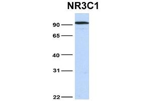 Host:  Rabbit  Target Name:  NR3C1  Sample Type:  Hela  Antibody Dilution:  1.