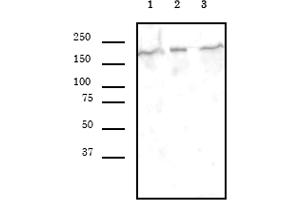 Western Blotting (WB) image for anti-SWI/SNF Related, Matrix Associated, Actin Dependent Regulator of Chromatin, Subfamily A, Member 4 (SMARCA4) (AA 213-295) antibody (ABIN6972735)