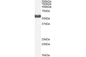 Western Blotting (WB) image for anti-Cytochrome P450, Family 2, Subfamily D, Polypeptide 6 (CYP2D6) (C-Term) antibody (ABIN6391374)