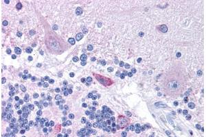 Human Brain, Cerebellum (formalin-fixed, paraffin-embedded) stained with HTR3B antibody ABIN214778 at 5 ug/ml followed by biotinylated goat anti-rabbit IgG secondary antibody ABIN481713, alkaline phosphatase-streptavidin and chromogen. (Serotonin Receptor 3B 抗体  (N-Term))