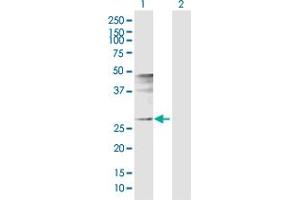 Western Blot analysis of FOSL1 expression in transfected 293T cell line by FOSL1 MaxPab polyclonal antibody. (FOSL1 抗体  (AA 1-271))