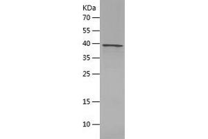 Western Blotting (WB) image for Interleukin 7 (IL7) (AA 26-177) protein (His-IF2DI Tag) (ABIN7123614) (IL-7 Protein (AA 26-177) (His-IF2DI Tag))