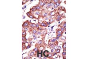 Immunohistochemistry (IHC) image for anti-Toll Interacting Protein (TOLLIP) antibody (ABIN3001486) (TOLLIP 抗体)