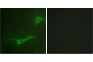 Immunofluorescence analysis of NIH-3T3 cells, using MUNC-18a (Ab-313) Antibody. (STXBP1 抗体  (AA 279-328))