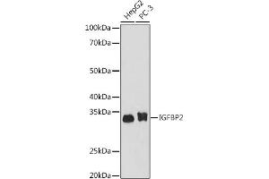 Western blot analysis of extracts of various cell lines, using IGFBP2 antibody (ABIN7267907) at 1:1000 dilution.