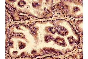 Immunocytochemistry analysis of human prostate tissue using ABIN7161840 at dilution of 1:100 (NUP214 抗体  (AA 28-238))