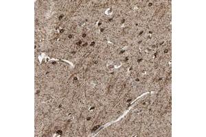 Immunohistochemical staining of human cerebral cortex with SHROOM4 polyclonal antibody  shows strong cytoplasmic positivity in neuronal cells at 1:50-1:200 dilution.